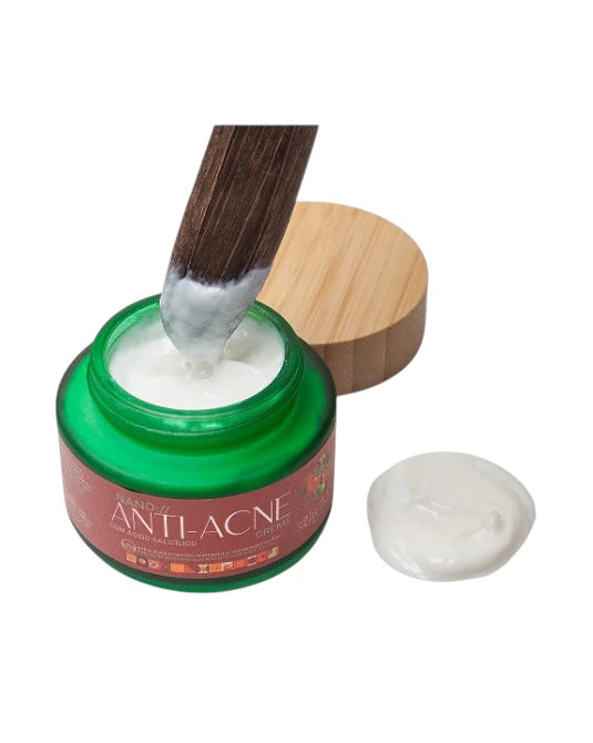 Creme Facial Antiacne – Kaki Cosmetics